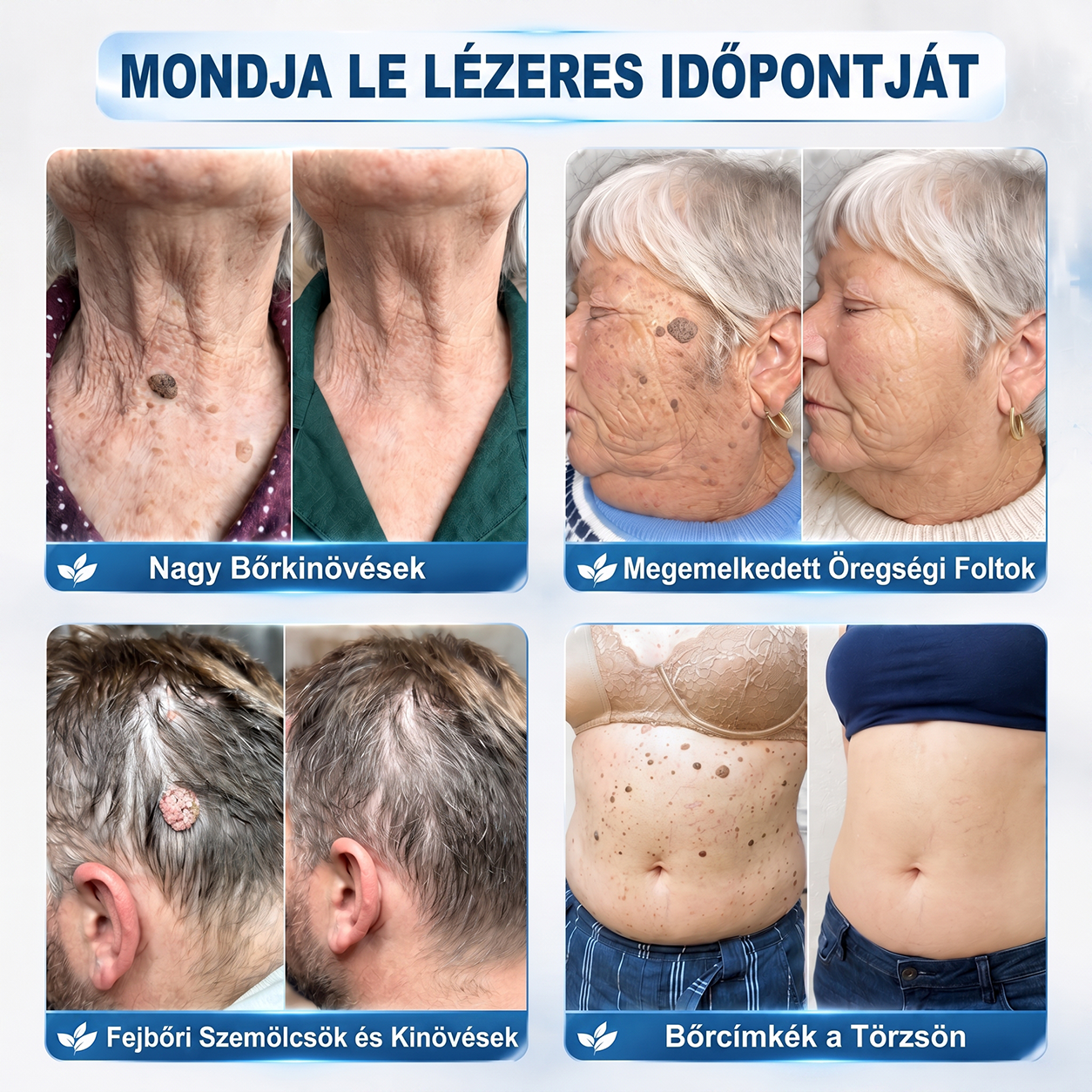 🌿𝐇𝐢𝐒𝐤𝐢𝐧® 🎁 Már csak 2 doboz maradt! A 𝐇𝐢𝐒𝐤𝐢𝐧® 🎁további 50% kedvezményt ad! Állítsd helyre a tested és az egészséged.
