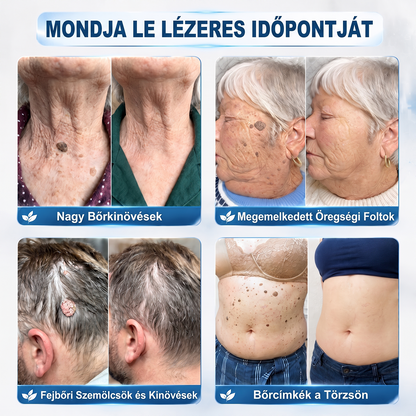 🌿𝐇𝐢𝐒𝐤𝐢𝐧® 🎁 Már csak 2 doboz maradt! A 𝐇𝐢𝐒𝐤𝐢𝐧® 🎁további 50% kedvezményt ad! Állítsd helyre a tested és az egészséged.