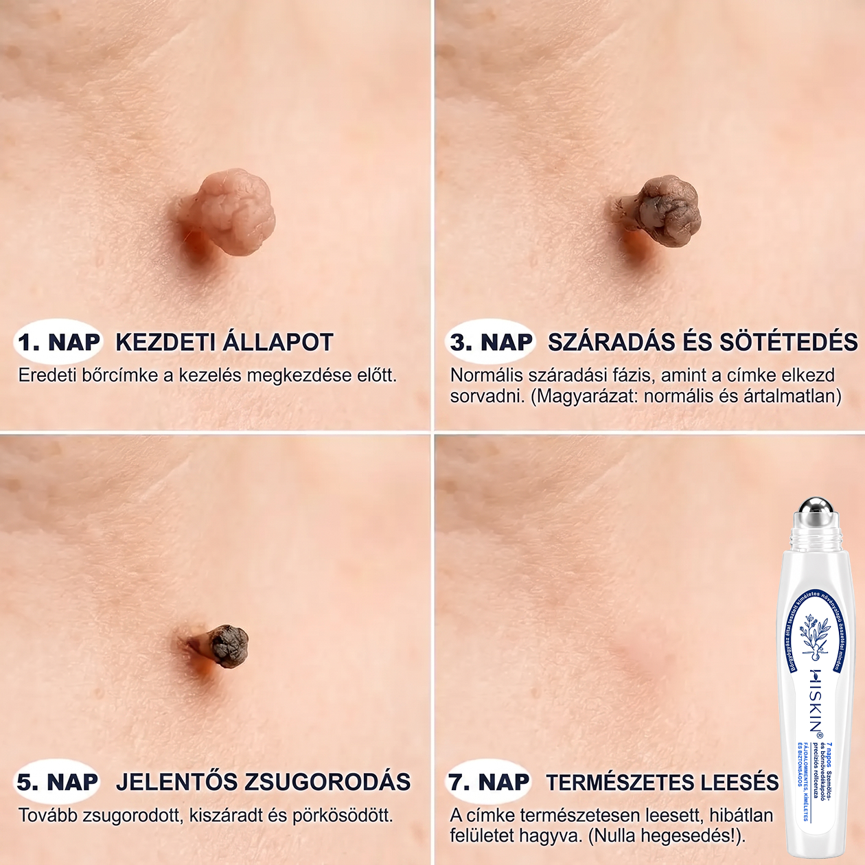 🌿𝐇𝐢𝐒𝐤𝐢𝐧® 🎁 Már csak 2 doboz maradt! A 𝐇𝐢𝐒𝐤𝐢𝐧® 🎁további 50% kedvezményt ad! Állítsd helyre a tested és az egészséged.