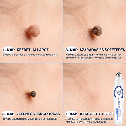 🌿𝐇𝐢𝐒𝐤𝐢𝐧® 🎁 Már csak 2 doboz maradt! A 𝐇𝐢𝐒𝐤𝐢𝐧® 🎁további 50% kedvezményt ad! Állítsd helyre a tested és az egészséged.