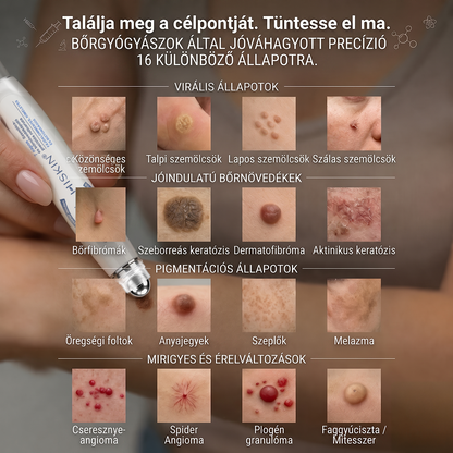 🌿𝐇𝐢𝐒𝐤𝐢𝐧® 🎁 Már csak 2 doboz maradt! A 𝐇𝐢𝐒𝐤𝐢𝐧® 🎁további 50% kedvezményt ad! Állítsd helyre a tested és az egészséged.